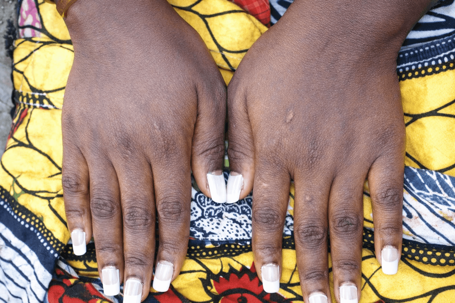 Atividade no Congo 5